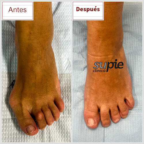 Clínica Supie
